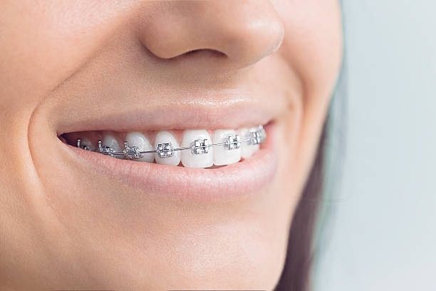 Best Veneers and Lumineers  in Jonesboro, IL